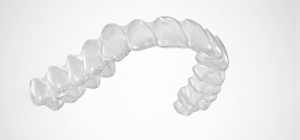 Clear Aligners simi valley