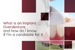 What is an Implant Overdenture, and how do I know if I'm a candidate for it