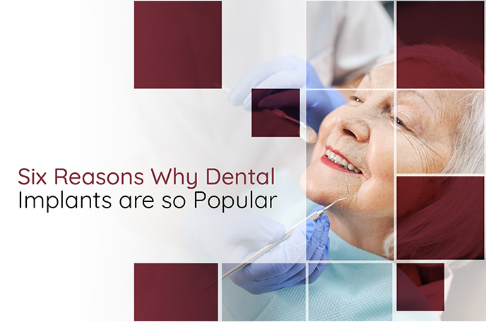 Six Reasons Why Dental Implants are so Popular