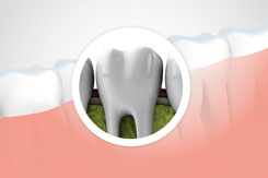 Simi Valley Dentist Explains Five Interesting Facts you didn't know about your Teeth